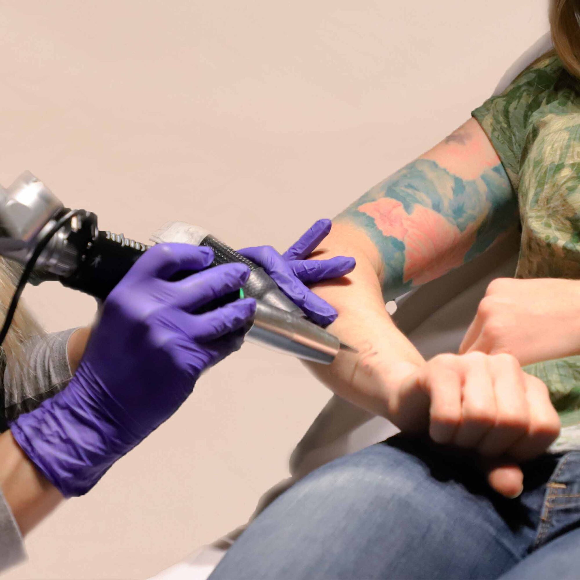 Why You Should Schedule Your Laser Tattoo Removal after the New Year? -  Connecticut Tattoo Removal